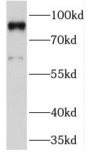 PRICKLE1 antibody|PRICKLE1抗体