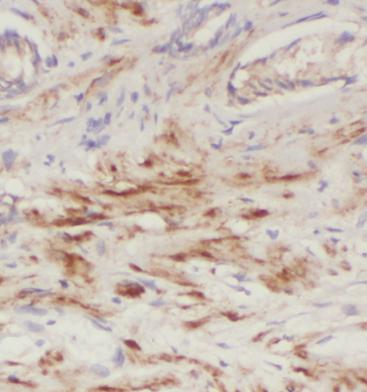 PDGFD antibody|PDGFD抗体