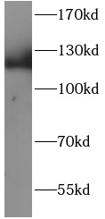 EML4 antibody|EML4抗体 FNab10047