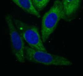ACOT2 antibody|ACOT2抗体