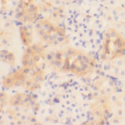 FIZ1 antibody|FIZ1抗体 FNab02508