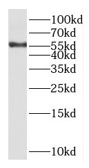 KCNV1 antibody|KCNV1抗体
