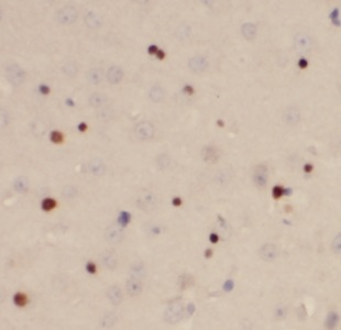 USP11 antibody|USP11抗体 FNab093