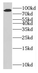 GFM2 antibody|GFM2抗体