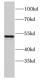 CCDC6 antibody|CCDC6抗体