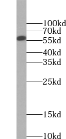 UTP15 antibody|UTP15抗体