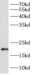 ARL8A antibody|ARL8A抗体