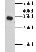 CLTB antibody|CLTB抗体