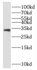 EBAG9 antibody|EBAG9抗体