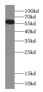 CES5A-Specific antibody|CES5A抗