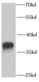 PPP2CA antibody|PPP2CA抗体