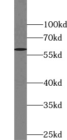 TOR1AIP2 antibody|TOR1AIP2抗体