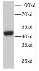 DOC2B antibody|DOC2B抗体