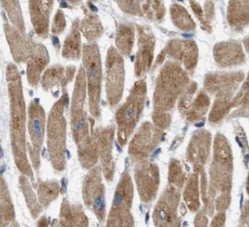 HCN1 antibody|HCN1抗体 FNab03787
