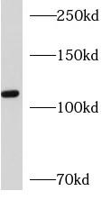 AP3D1 antibody|AP3D1抗体
