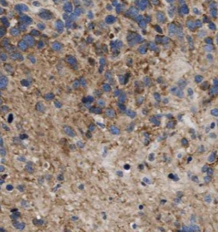 ARPP19 antibody|ARPP19抗体