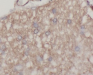 Beta Tubulin antibody|Beta Tub