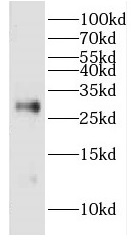 DCXR antibody|DCXR抗体