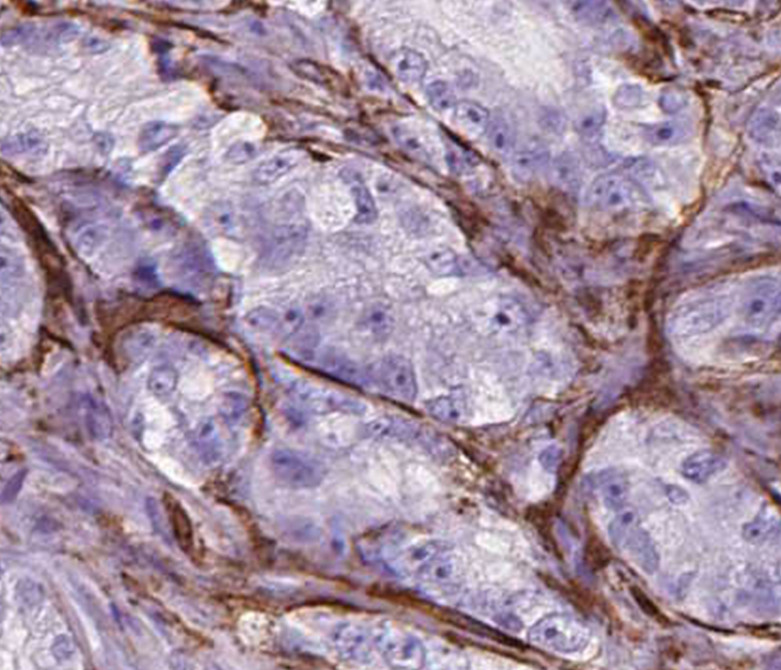 RTKN antibody|RTKN抗体