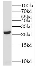 SNRPB antibody|SNRPB抗体