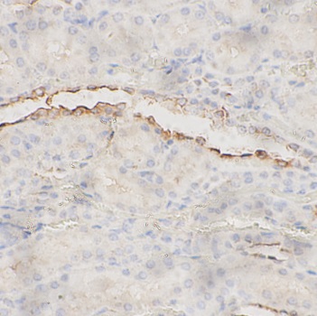 SLC4A1 antibody|SLC4A1抗体 FNab1