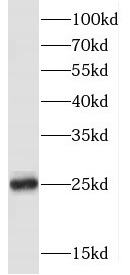 FKBP3 antibody|FKBP3抗体