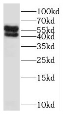 SLC18A1 antibody|SLC18A1抗体