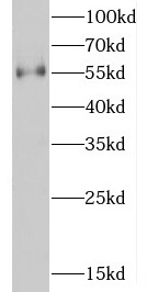 D2HGDH antibody|D2HGDH抗体