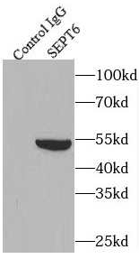 POLR2E antibody|POLR2E抗体