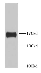 HDAC6 antibody|HDAC6抗体 FNab038