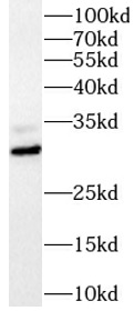 SNAI2 antibody|SNAI2抗体