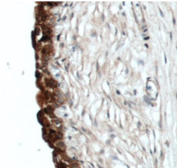 UPK2 antibody|UPK2抗体 FNab09274