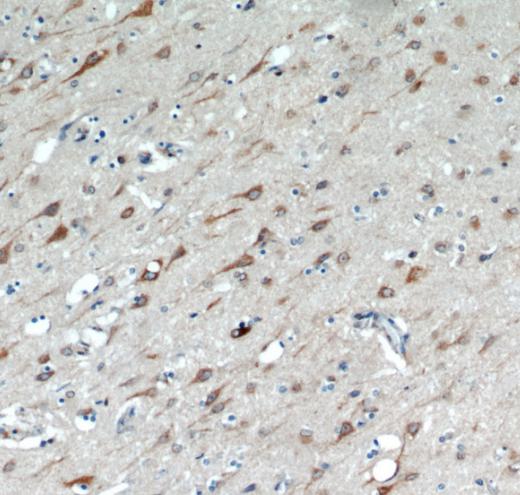 TMX4 antibody|TMX4抗体