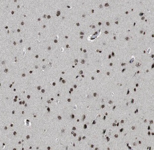 NCDN antibody|NCDN抗体