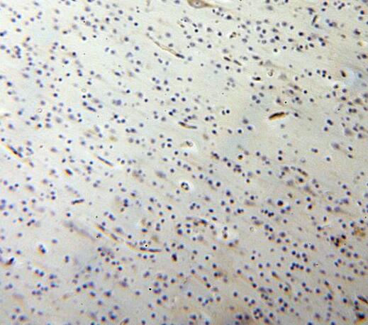 SQOR antibody|SQOR抗体