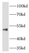 THUMPD1 antibody|THUMPD1抗体