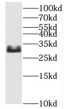 Histone H1 antibody|Histone H1