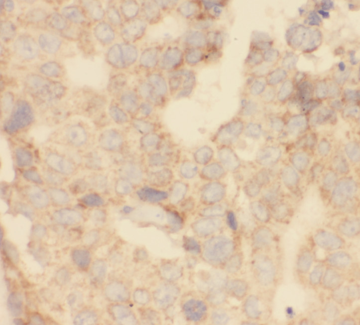 EBAG9 antibody|EBAG9抗体