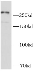 NCOR2 antibody|NCOR2抗体 FNab100
