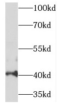 TES antibody|TES抗体