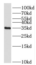 FOXS1 antibody|FOXS1抗体