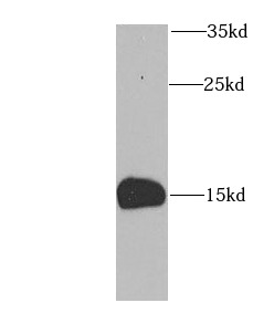 FABP5 antibody|FABP5抗体