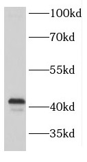 FANCL antibody|FANCL抗体 FNab030