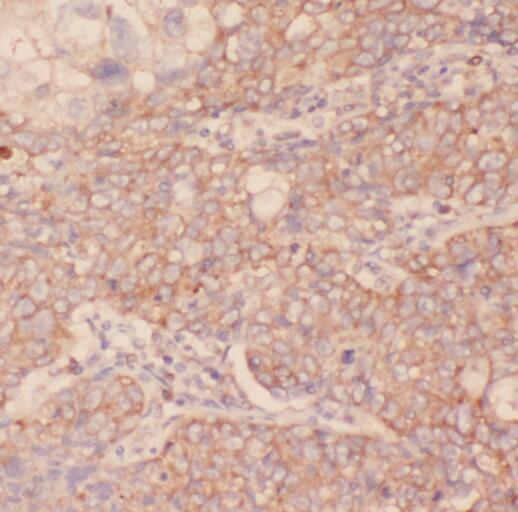 PKLR antibody|PKLR抗体 FNab06490