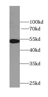 TTC7B antibody|TTC7B抗体