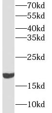 CFL1 antibody|CFL1抗体 FNab01826