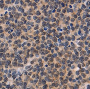 NDOR1 antibody|NDOR1抗体
