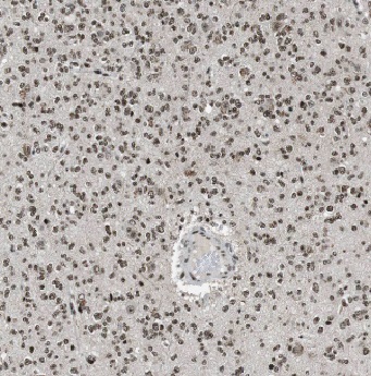 ADAP1 antibody|ADAP1抗体