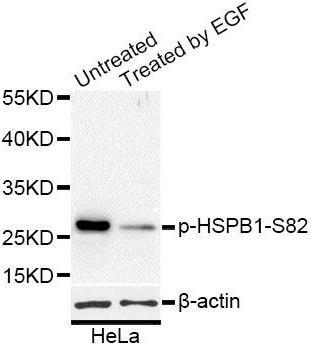 Phospho-HSPB1 (S82) antibody|P
