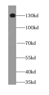 STXBP5 antibody|STXBP5抗体